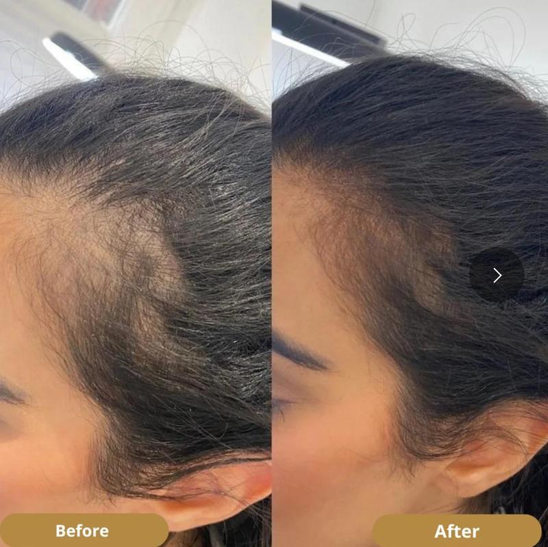 Naashays Naturals Intense Hydration & Hair Growth Bundle (5- Piece Set)