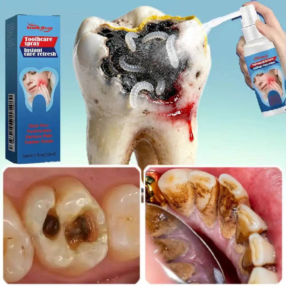 Oral Care Spray –Preventing tooth sensitivity，Relieve swollen and inflamed gums，Relieve tooth decay， Gentle Formula for Daily Use
