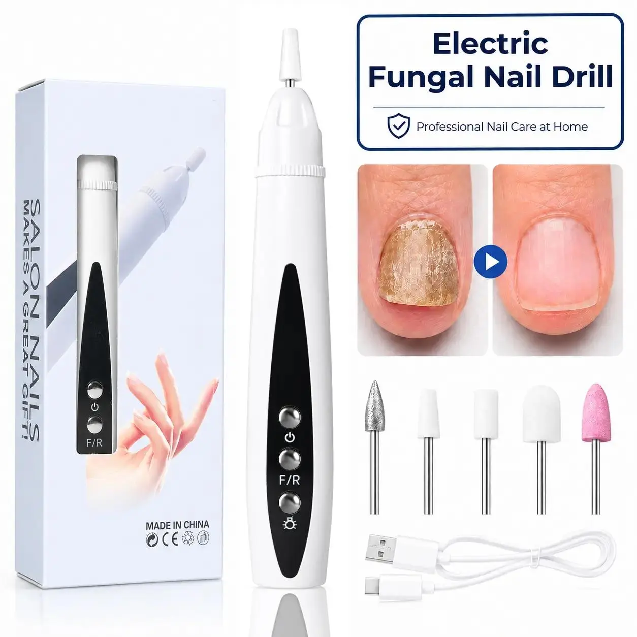 USB Rechargeable Electric Fungal Nail Drill - 5-Speed Pedicure Toenail Grinder with Rotation Switch, UV Light, 5 Grinding Bits, Portable Tool for Thick Damaged Discolored Nails, At-Home Onychomycosis Care #backtoschool