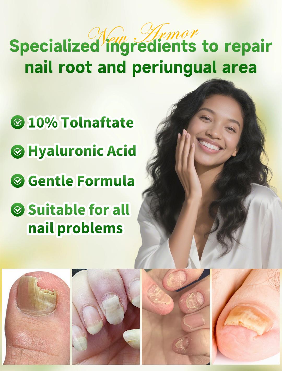 【Special effects】Toenail Fungus Extra Strength,Antifungal Solution for Toenail or Fingernail, Triple ActionFormula for Remove Fungal, Repair and Renewal DamagedNails. 【Special effects】Toenail Fungus Extra Strength,Antifungal Solution for Toenail or Fingernail, Triple ActionFormula for Remove Fungal, Repair and Renewal DamagedNails.