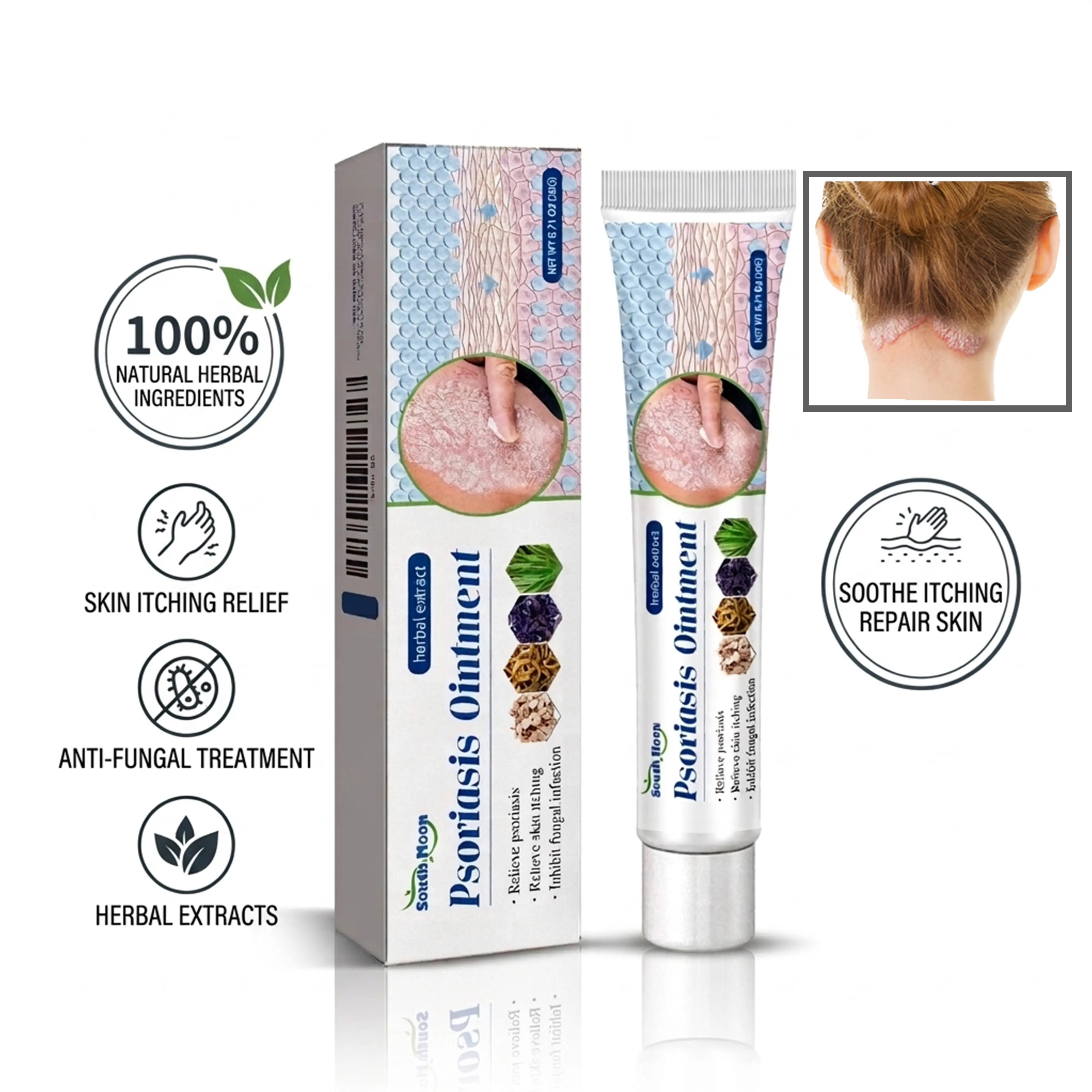 Psoriasis Cream, Natural Herbal Ointment for Eczema & Dermatitis, Instant Itch Relief, Anti-Fungal Treatment, Soothes Skin Redness and Peeling, 20g, Cream Form