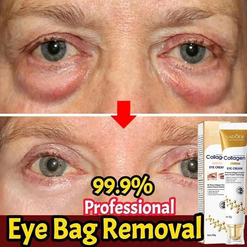 Collagen Eye Cream - Moisturizing Under Eye Brightener with Hydration Boost, Drop Formula for Wrinkles, Fine Lines, Dark Circle Reduction, Firming, Repairing, Suitable for All