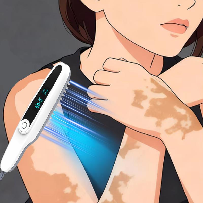 UVB 311nm Phototherapy Lamp Handheld Light Therapy Device for Vitiligo