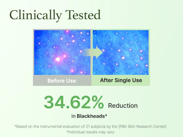 [Arencia Official] Pore Melt Double Cleansing Duo - Acne & Pore Safe Gentle Makeup-Removing Cleansing Oil & Foaming Wash with Rice, Vitamin E, Green Tea, Witch Hazel for Clear Skin, Pore Melt Mochi Cleansing Oil & Fresh Green Rice Mochi Cleanser 