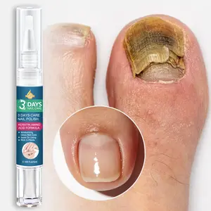 SUMIEANG Nail Care Serum 5ml | Keratin & Amino Acid Repair + Salicylic Acid Exfoliation + Vitamin C Brightening | Compact & Portable — Ideal for Daily Hand & Foot Care Nail Care Solution