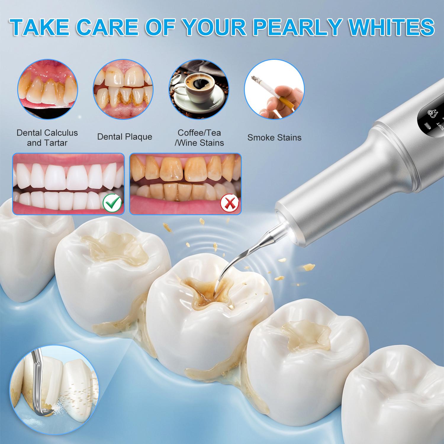 Electric Teeth Cleaner – Ultrasonic Dental Plaque Remover with 5 Cleaning Modes, Smart Detection, Long Battery, Waterproof, Dental Picks & Mirror for Home Oral Care
