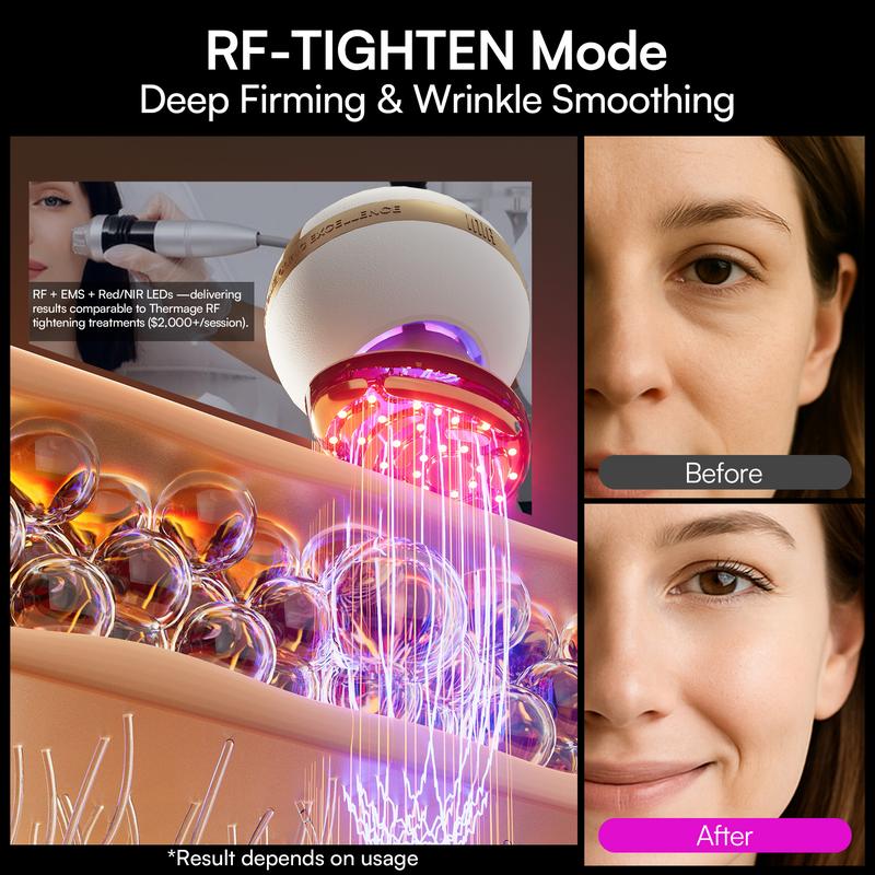 【LIVE EXCLUSIVE】INIA SPHERA At-Home RF & LED Anti-Aging Facial Device – Lift, Tighten & Sculpt with EMS Microcurrent, Red Light Therapy, Electroporation & Cryo Cooling for Firm, Glowing Skin. Perfect Black Friday Gift.