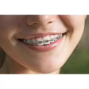 Colorful Hook Temporary Teeth Decoration with Wire, Metal Bracket & Correction Ligature - Easter Style Dental Student Practice Props boxing equipment Oral oral use stainless steel temporary veneer metal dental brace durable dental material