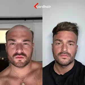 [Lordhair] SuperSkin|0.08mm Super Thin Skin Men's Hair Pieces Hair Systems