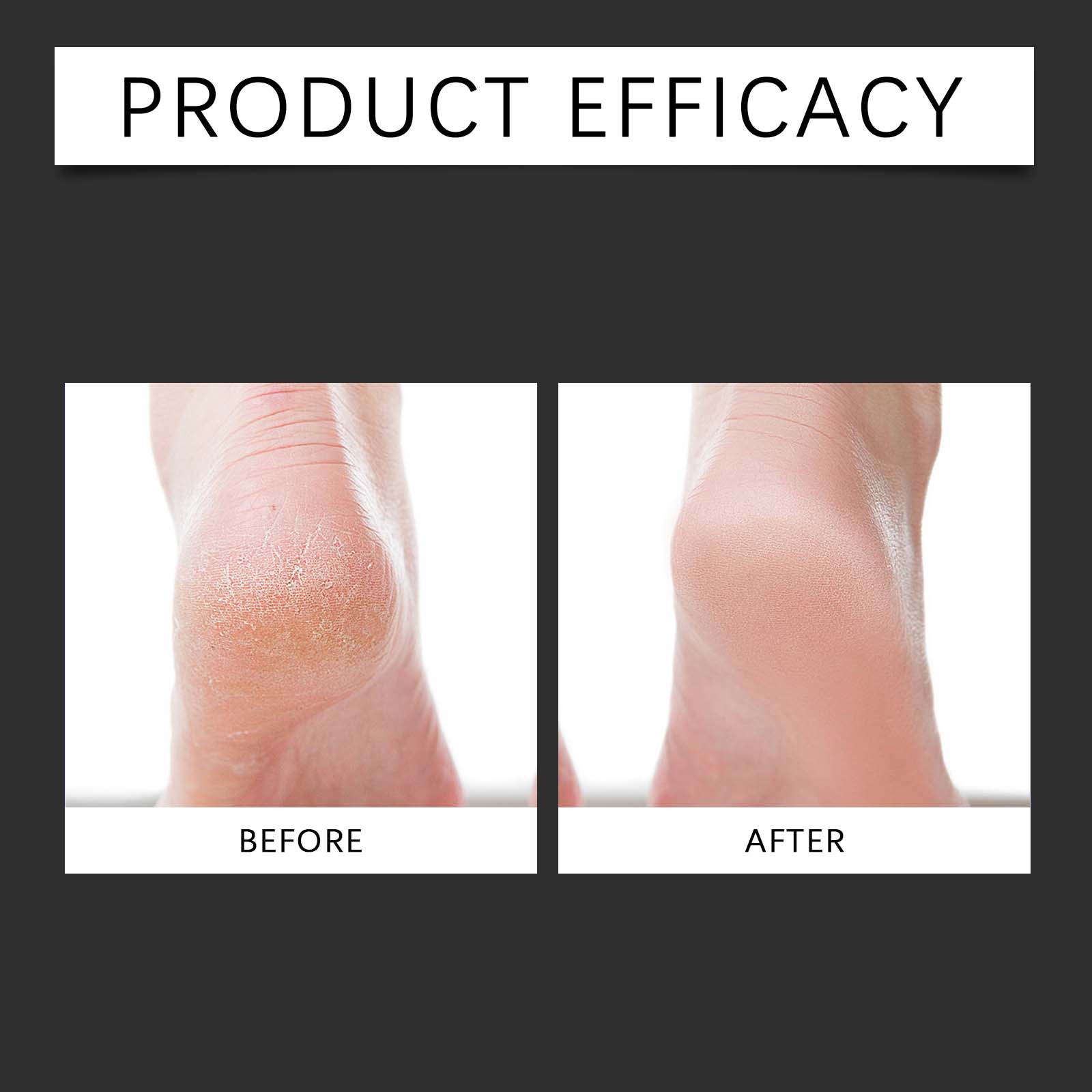 Foot Moisturizing Cream - Nourishing and Hydrating Care for Soles, Lightweight and Easily Absorbed Moisturizing Treatment