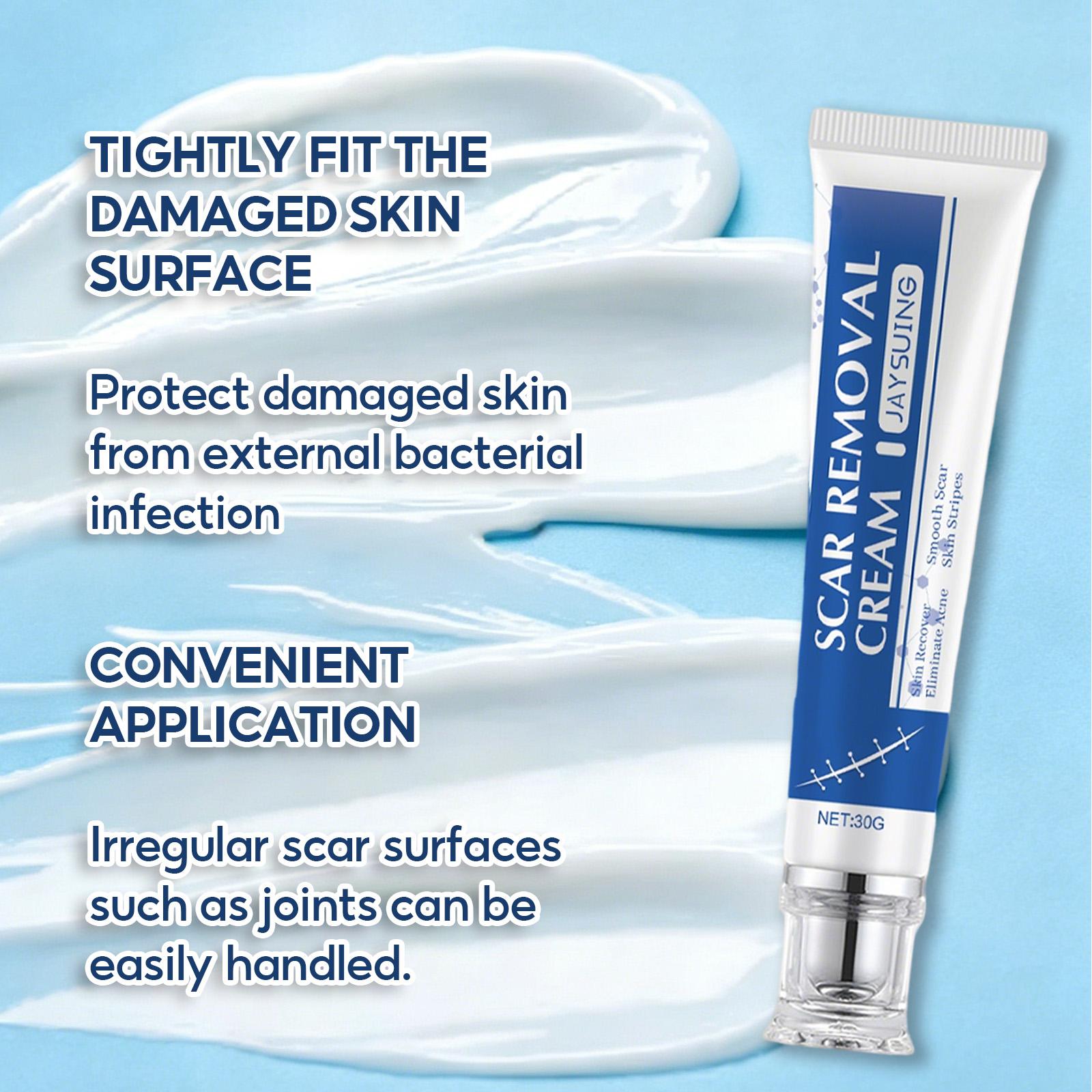 Advanced Scar Removal Cream for Old & New Scars - Silicone Gel Formula for Surgical, Acne, Keloid, Burn & Stretch Mark Repair, Smooths & Hydrates Skin, 30g