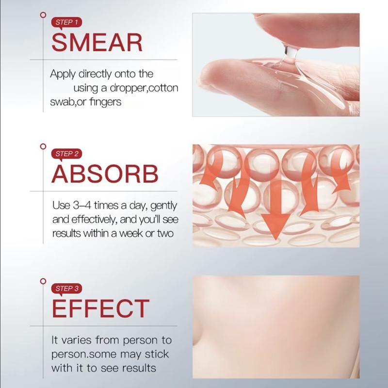 5% Salicylic Acid Serum | 100% Natural Rapid-Removal, Skin-Renewing Powerhouse - 1 fl oz (30ml) for All