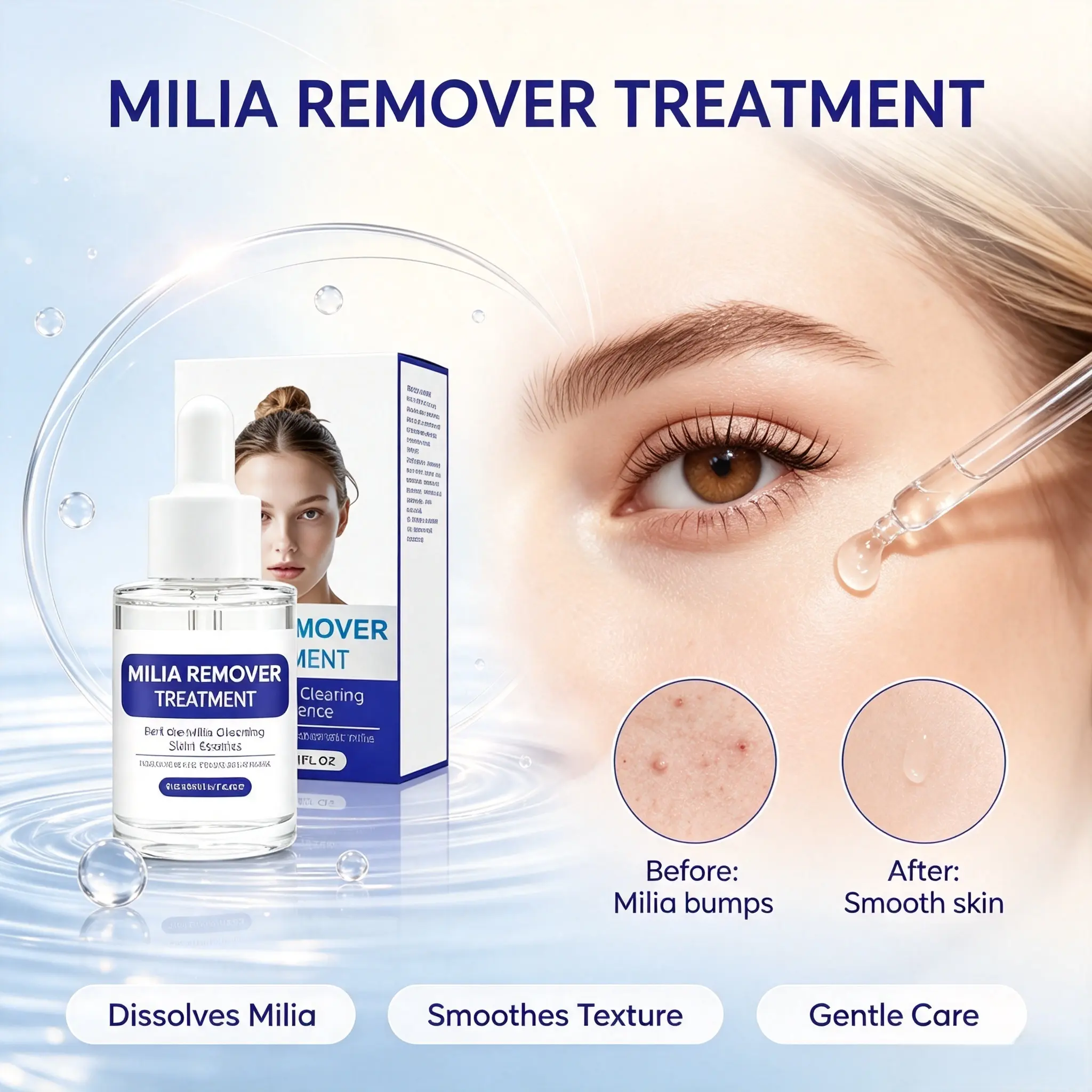 Milia Treatment Serum with Salicylic & Hyaluronic Acid, Gentle Pore Refining Blemish Treatment for Sensitive & Acne-Prone Skin, 30 ml Dropper Bottle, Salicylic Acid, Redness