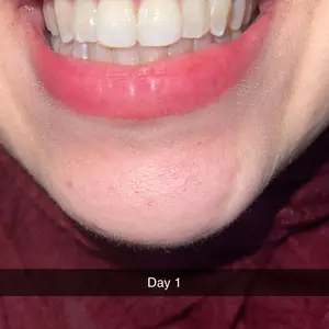 Product Review of GuruNanda Whitening Strips, 7-day treatment (7 Packets - 2 Strips per pack) - Non-Slip, Dry Strip Technology from O**s ♣**