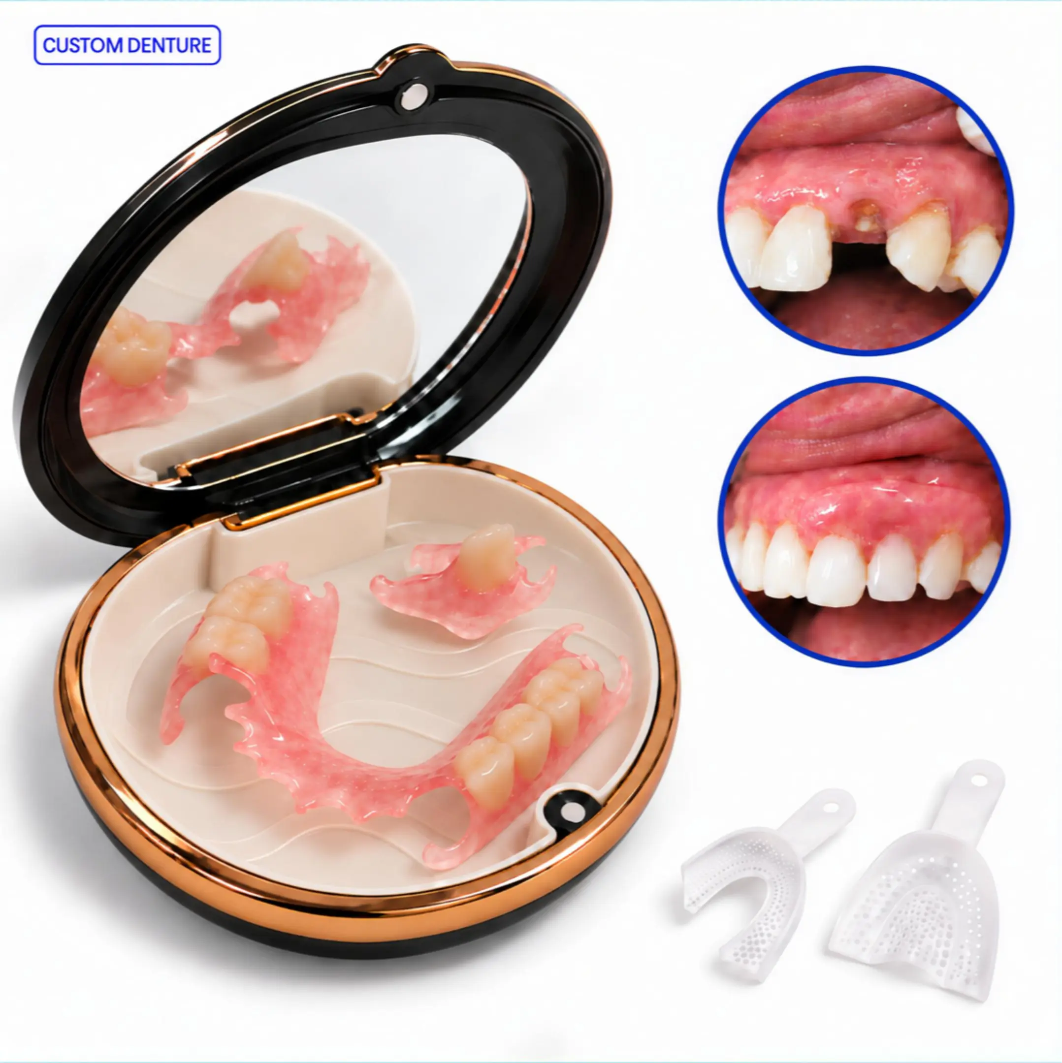 SMYLON Custom Flexible Partial Denture Flipper Tooth - Oral Care Solution for 1-4 Missing Front/Side Teeth, Removable Temporary Replacement with Home Impression Kit, densure fit