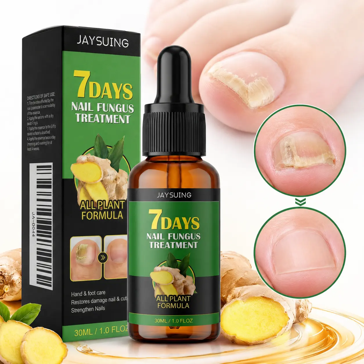 Nail Repair Care Serum with Powerful Ginger Plant-Derived Botanical Formula for Discolored, Thickened & Damaged Nails and Cuticles