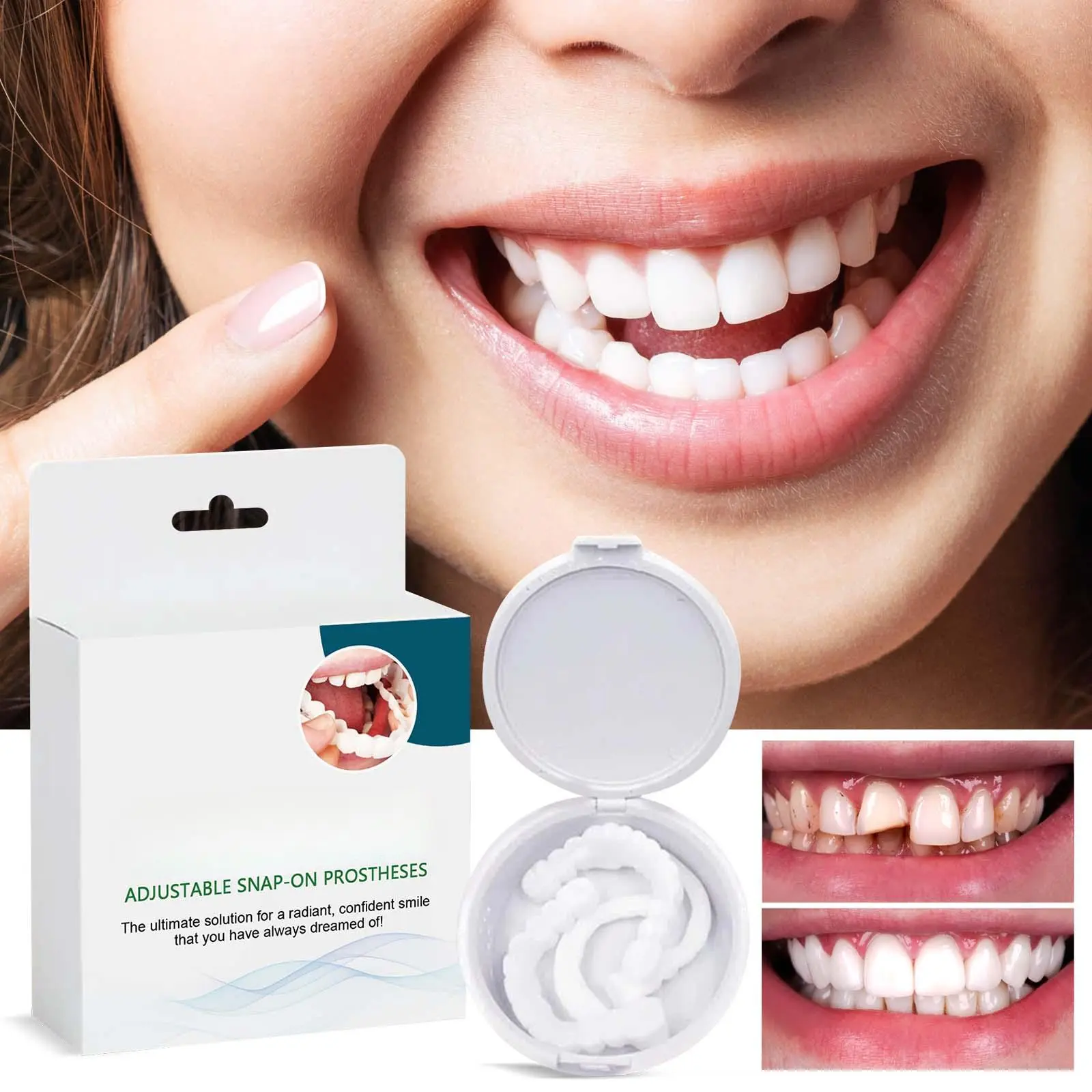 Adjustable Snap-on Dentures - The Best Gift for Boys and Girls' Dental th.A Denture Kit for Teeth Modification, Closing Tooth Gaps, Braces and Orthodontics.dental brace
