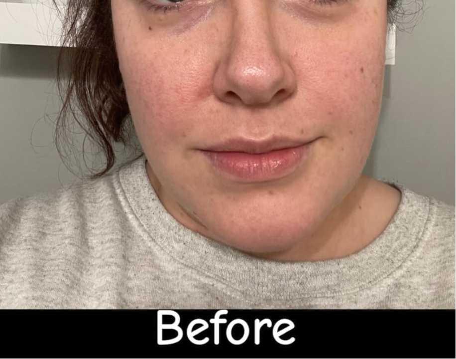 Item: Golden Micro-Peptide Tallow Serum 100g