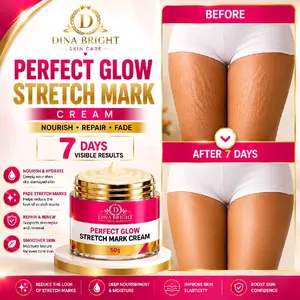 STRETCH MARKS CREAM.