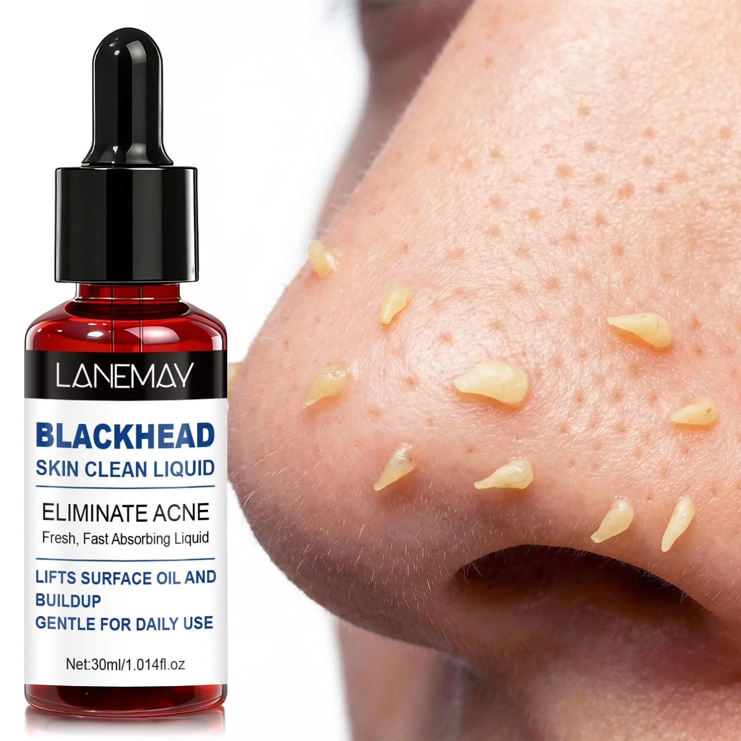 Blackhead removal facial cleansing solution gently dissolves blackheads and sebum, unclogs pores, improves closed comedones, soothes oily and acne-prone skin, dissolves accumulated sebum in pores, and improves blackhead removal Daily