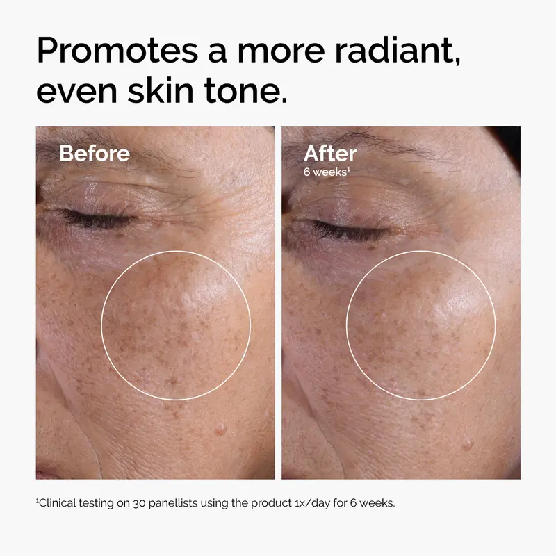 The Ordinary Glycolic Acid 7% Exfoliating Toner, Brightening and Smoothing Daily Toner for More Even-Looking Skin Tone 1