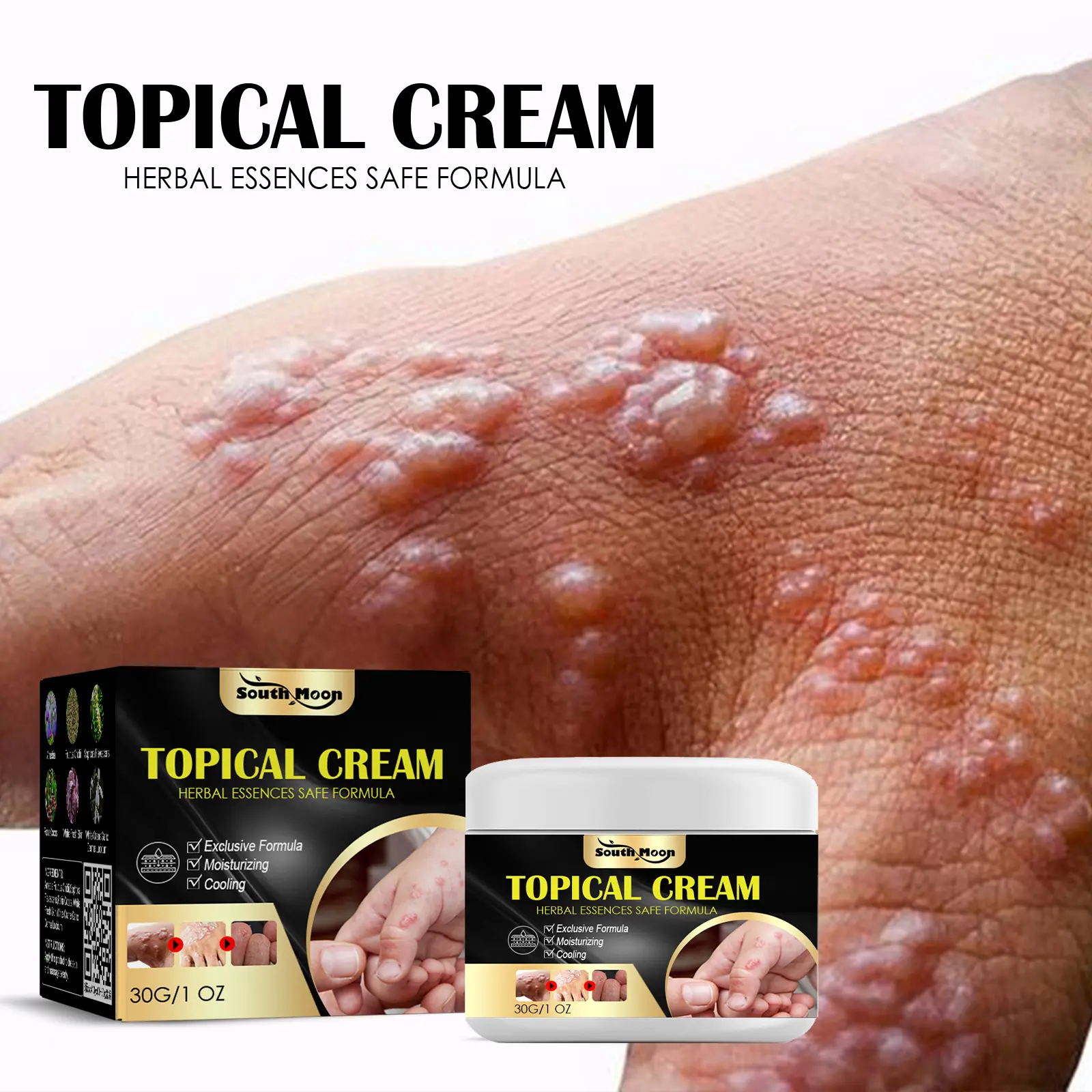 South Moon Itch Relief Body Cream for Hands & Feet – Soothes Dry, Itchy Skin & Relieves Pruritus; Repairing Care Cream