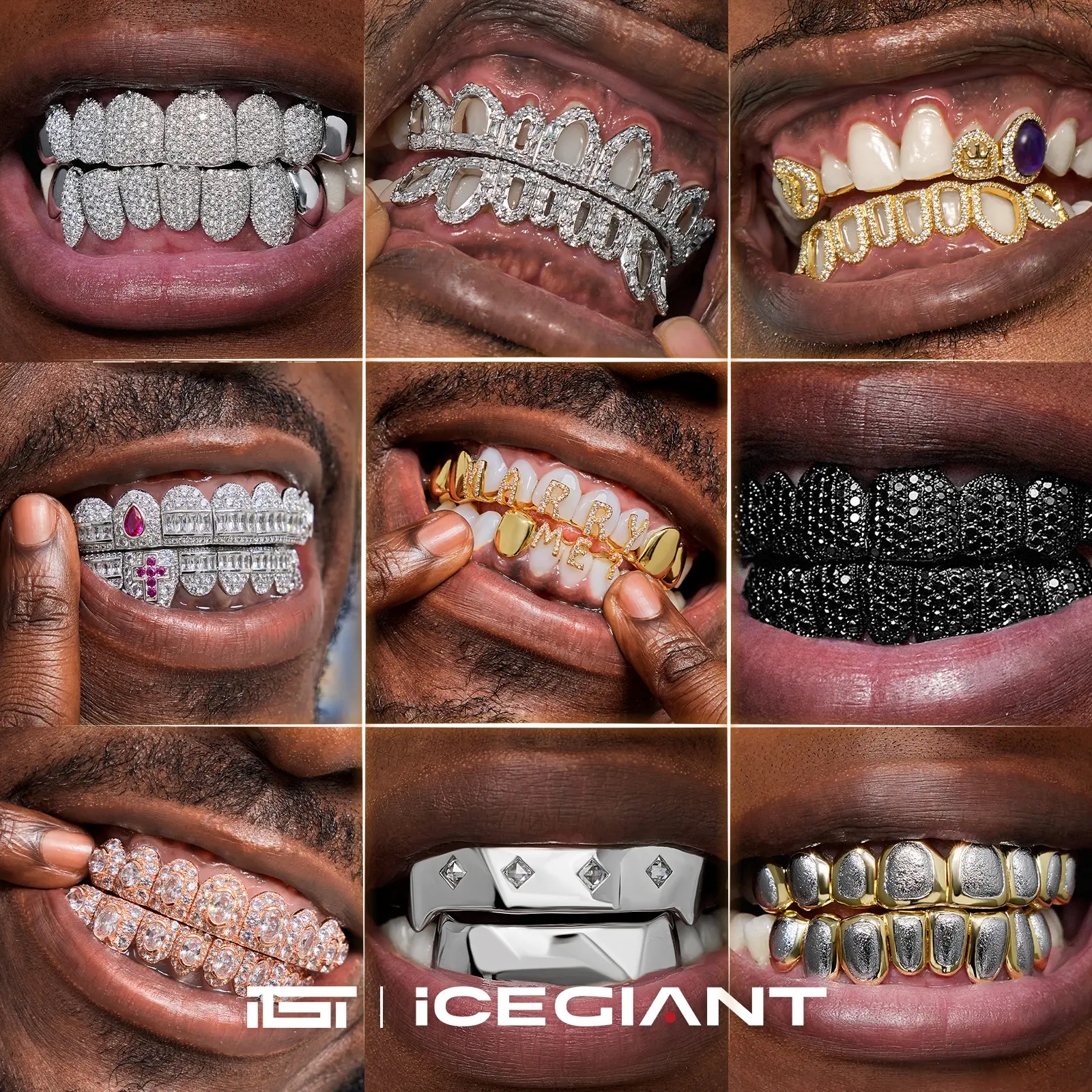 IGT Custom Hip-Hop Grillz – Mold Kit Deposit