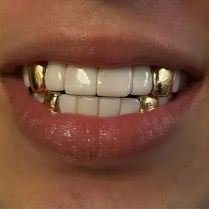 THATBOY 4pcs/Set New Style 18K Golden Plated Hip Hop Teeth Grillz With Star Cubic Zirconia Caps Micro Pave Top & Bottom Charm Grills For Men Women Jewelry