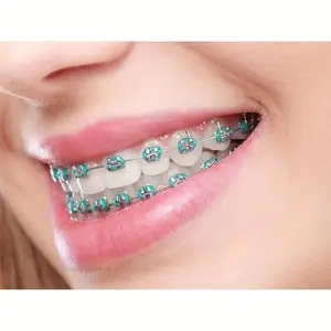 2025 Colorful Temporary Teeth Decorations |             Cosplay Braces with Rubber Bands & Stainless Steel |             Vibrant Party Style for Halloween, Thanksgiving, Christmas |             Durable, Easy-to-Use Beauty Retouching Gear Metal Fashion Den