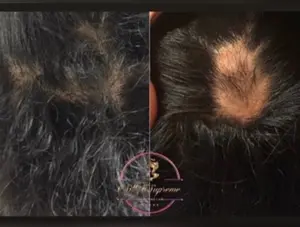 Silk Supreme Hair Growth Serum