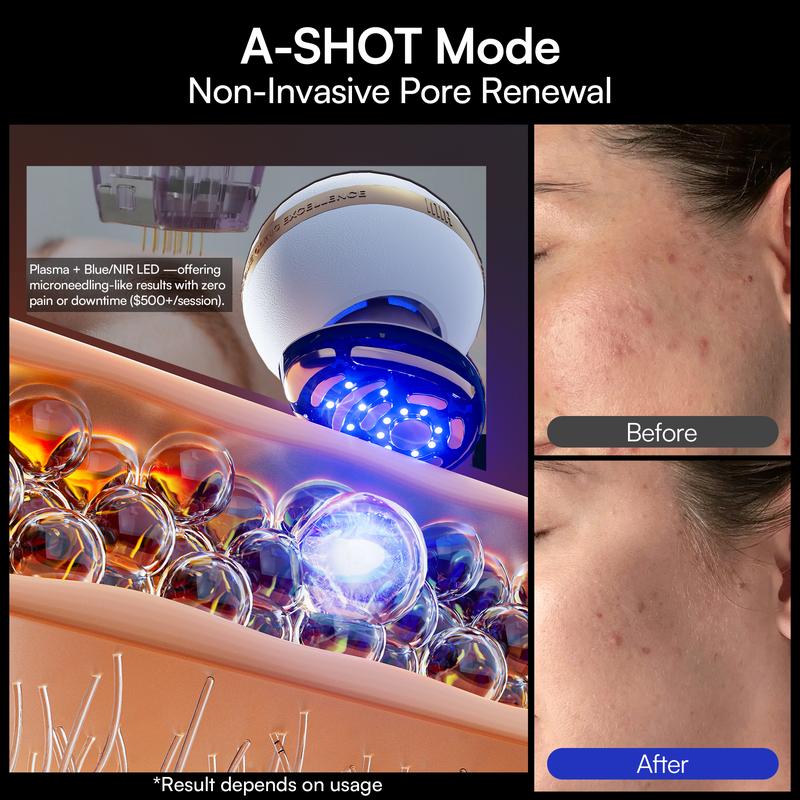 【LIVE EXCLUSIVE】INIA SPHERA At-Home RF & LED Anti-Aging Facial Device – Lift, Tighten & Sculpt with EMS Microcurrent, Red Light Therapy, Electroporation & Cryo Cooling for Firm, Glowing Skin. Perfect Black Friday Gift.