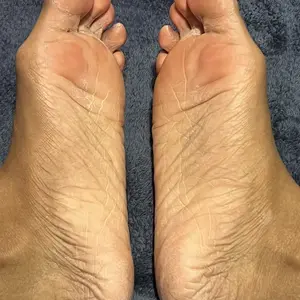 Moisturizing Gel Socks For Dry, Cracked Feet