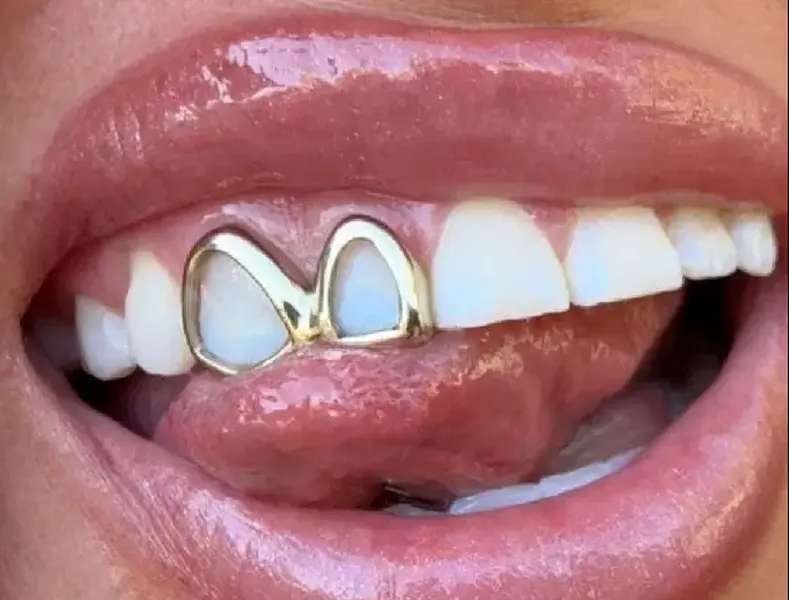 14K Gold Plated Double Open Face Grillz Set 14K Gold Plated Double Open Face Grillz Set