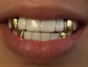 14K Gold Plated Single Cap 4pc Grillz Set