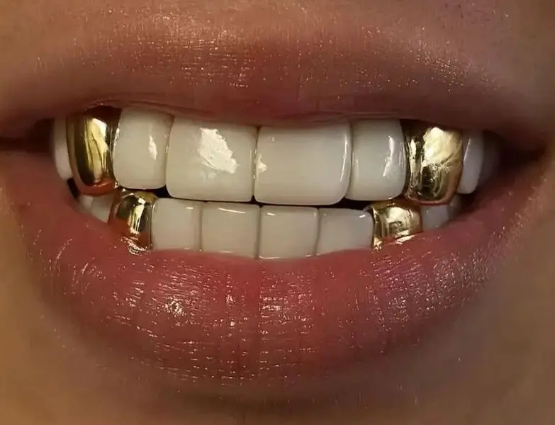 14K Gold Plated Single Cap 4pc Grillz Set