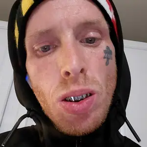 Hip-hop gold braces set, 8 upper and 8 lower teeth each, smooth braces, street casual style, rap, Teeth Kit