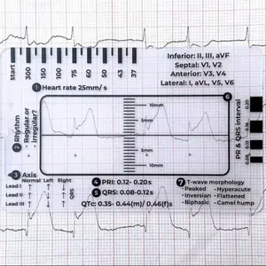 Ecg Ruler, 1 Count Heart Rate Monitoring ToolSuitable for Students Nurses Doctors, OfficeStationery & Supplies