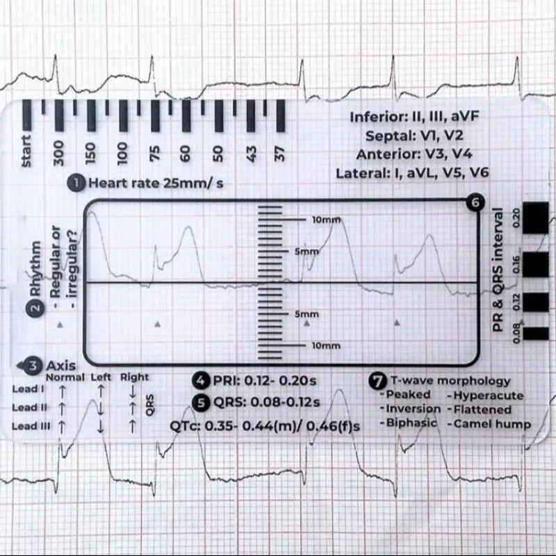 Ecg Ruler, 1 Count Portable Lightweight Heart Rate Monitoring Tool Suitable for Students Nurses Doctors, Office Stationery & Supplies