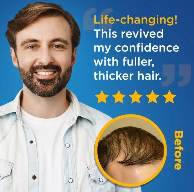 Kirkland 5% Minoxidil Unisex Topical Liquid Hair Growth Solution, Haircare Scalp Revitalizing Treatment for Thin & Uneven Hair, 3-Month Supply, Skin Lab Tested