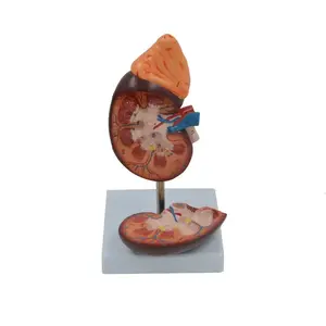 Enlarged Kidney Anatomical Model: Urinary System Anatomy