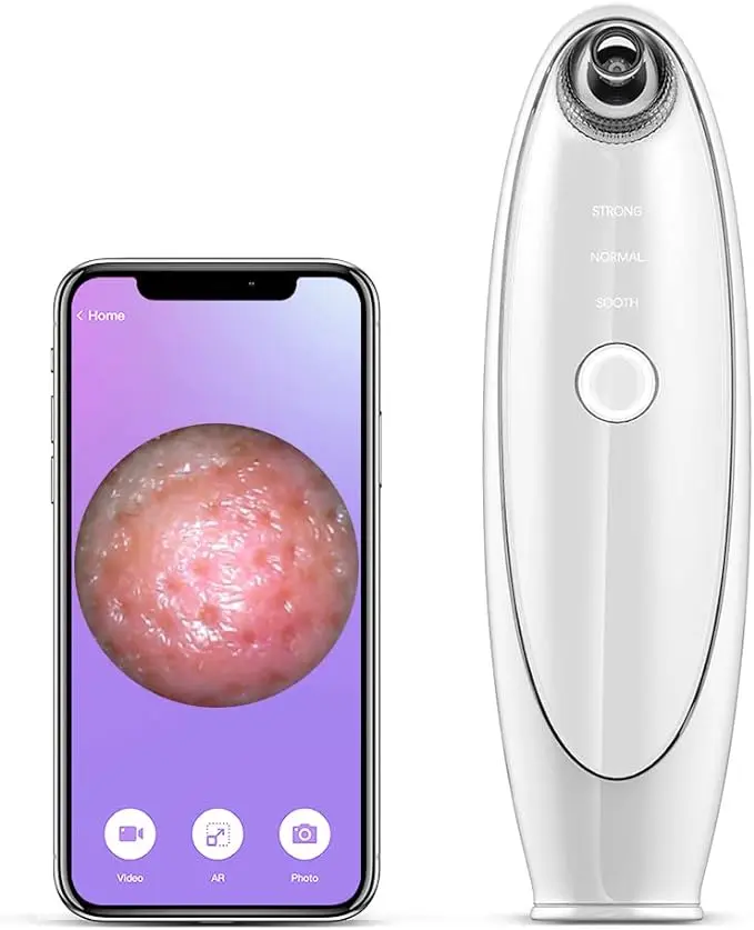 2024 latest blackhead remover, USB rechargeable blackhead remover, blackhead attractor with 1080p high-definition camera, electric visible blackhead remover tool