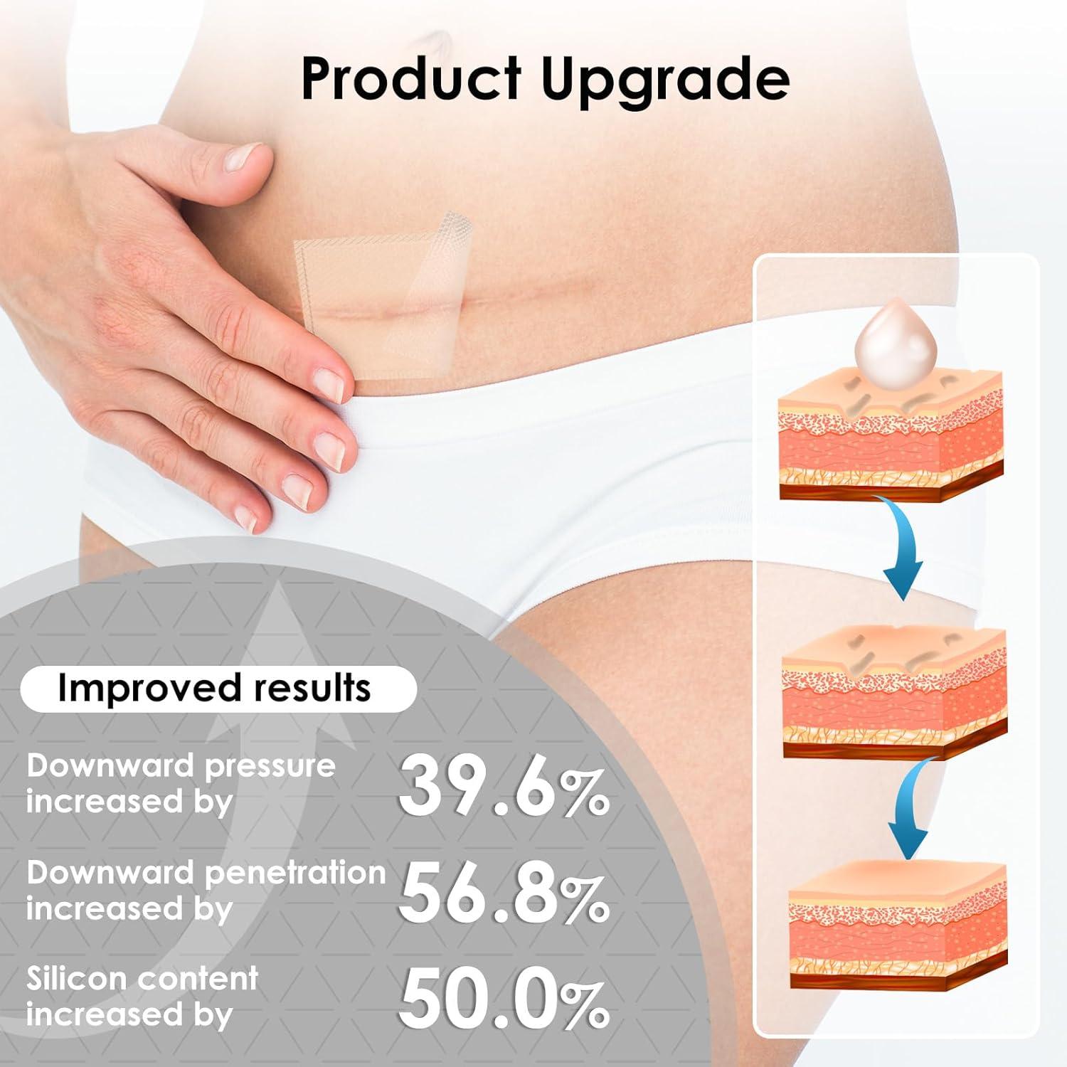 Silicone Scar Sheets,Silicone Scar Tape for Removal Treatment,Medical Grade Scar Tape for Surgical Scars,C-Section,Tummy Tuck,Scar Removal Away(1.6" x 60" Roll - 1.5M)