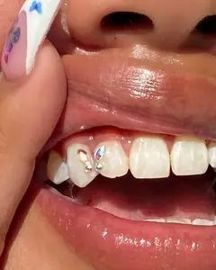 Butterfly Wingz Gemz Mega Pack