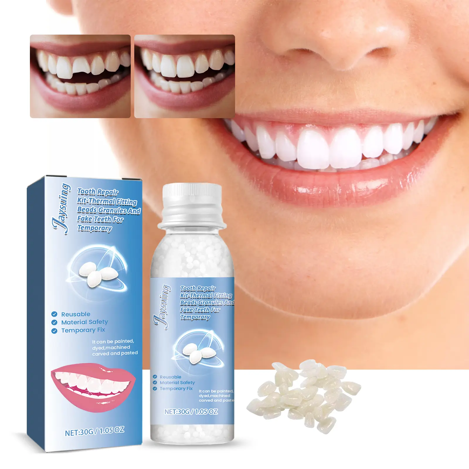 Temporary Tooth Repair Kit – Gap & Cavity Filler Gel, Denture Cosmetic Care, Teeth Beauty Gel