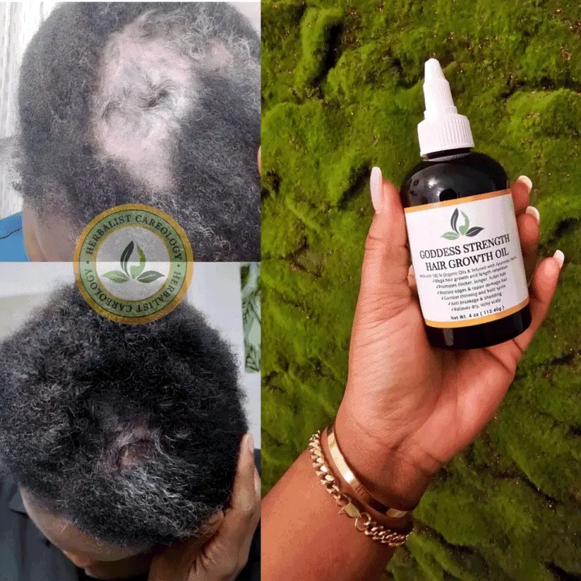 Herbalist Careology - Goddess Strength Hair Growth Oil - Hair Growth Oil for FAST Results with Indigenous Herbs to Regrowth, Alopecia, Thinning Edges, Bold Spots, Stagnant Growth Natural Haircare  for All Hair Types