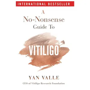 A No-Nonsense Guide To Vitiligo: Second Edition (2024)