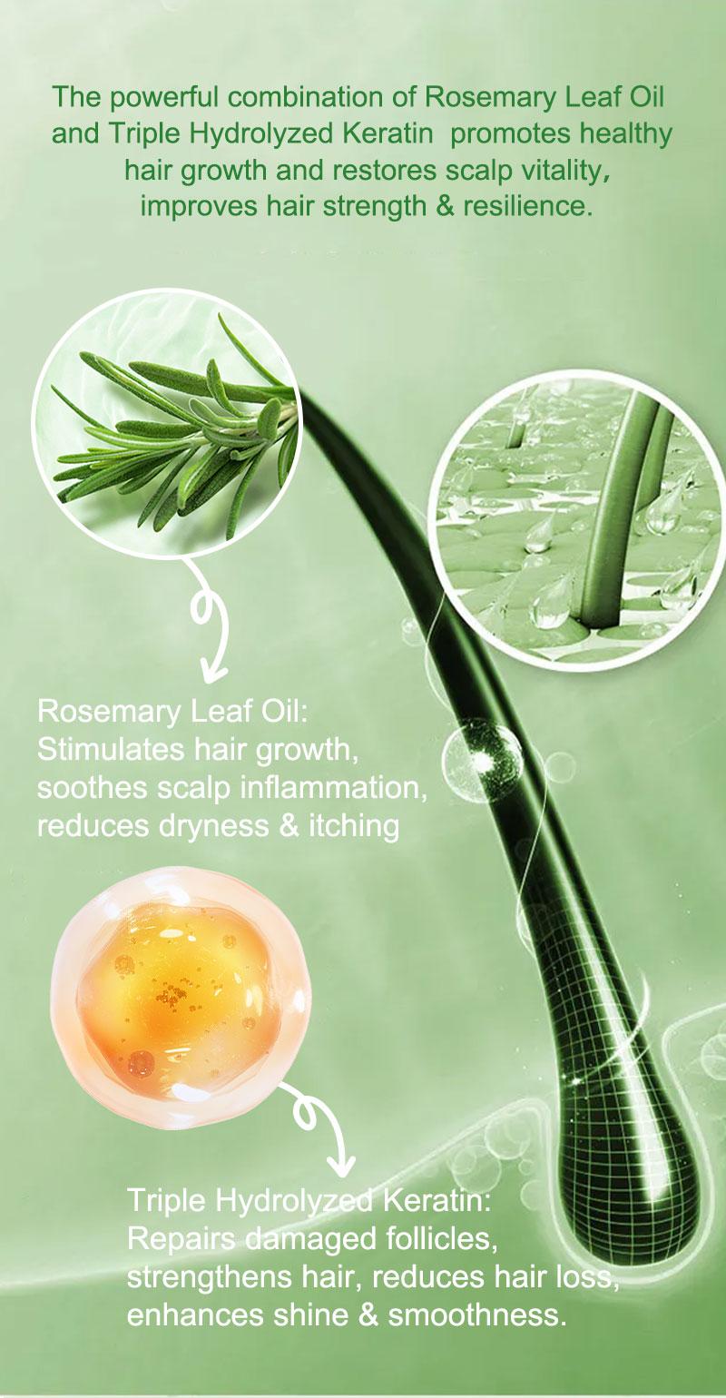 Tgideas Rosemary Shampoo  - Boost Hair Growth, Control Oil & Dandruff, Soothe Scalp Irritation & Restore Shine!