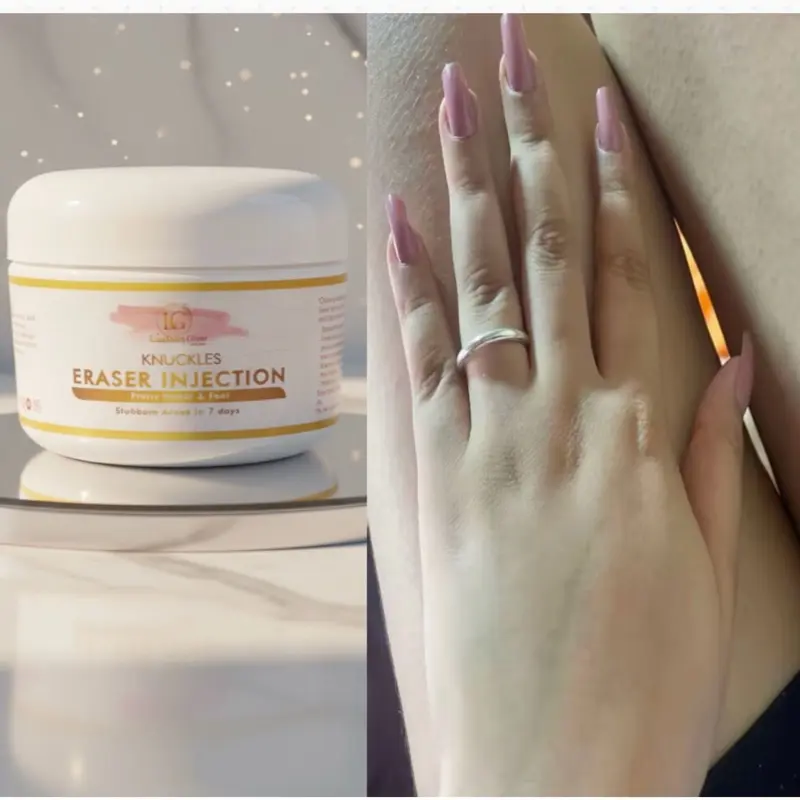 10X Strong Knuckles Eraser Cream for Beautiful Hand & Feetbright Stubborn Areas in 7 Days Body Exfoliating Beauty Products