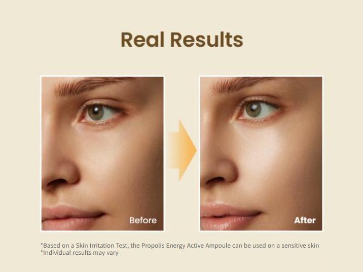 BEST Trio Exclusive Set (Propolis Energy Serum + Toner + Honey Lip Butter), 12hrs Long-lasting Hydrating & Soothing with Manuka Honey, Hyaluronic Acid, Non-Sticky Glow for Sensitive Skin, Glass Skin, Korean Skincare, Lip Plumper & Balm