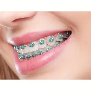 2025 Colorful Temporary Teeth Decorations |                   Cosplay Braces with Rubber Bands & Stainless Steel |                   Vibrant Party Style Halloween, Thanksgiving, Christmas |                   Durable, Easy-to-Use Beauty Retouching Gear Met